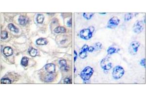 Immunohistochemistry (IHC) image for anti-BCL2-Associated Agonist of Cell Death (BAD) (AA 21-70), (Cleaved-Asp71) antibody (ABIN1536078)