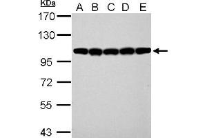 WB Image CSE1L antibody detects CSE1L protein by western blot analysis. (Exportin 2 抗体  (Center))