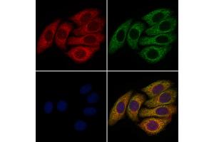 ABIN6258782 and ABIN6273627 staining Hela cells by IF/ICC.