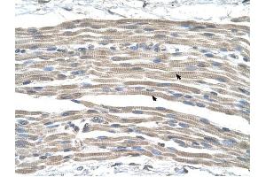 GPR161 antibody was used for immunohistochemistry at a concentration of 4-8 ug/ml to stain Skeletal muscle cells (arrows) in Human Muscle. (GPR161 抗体  (Middle Region))