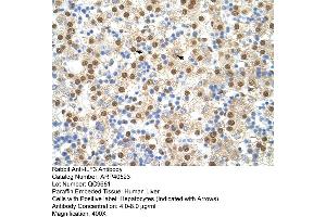 Rabbit Anti-ILF3 Antibody  Paraffin Embedded Tissue: Human Liver Cellular Data: Hepatocytes Antibody Concentration: 4. (Interleukin enhancer-binding factor 3 (ILF3) (N-Term) 抗体)
