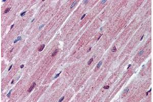 Human Heart: Formalin-Fixed, Paraffin-Embedded (FFPE) (SPNS2 抗体  (AA 71-120))