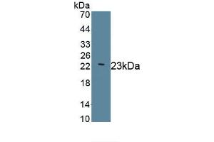 Detection of Recombinant LAMC2, Human using Monoclonal Antibody to Laminin Gamma 2 (LAMC2) (LAMC2 抗体  (AA 28-196))