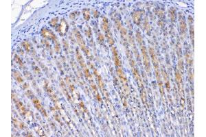 IHC analysis of TFF2 using anti-TFF2 antibody . (Trefoil Factor 2 抗体  (AA 24-129))