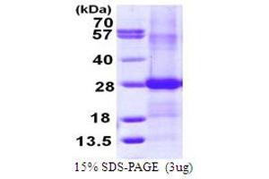 SDS-PAGE (SDS) image for Ephrin B2 (EFNB2) (AA 28-229) protein (His tag) (ABIN667564) (Ephrin B2 Protein (EFNB2) (AA 28-229) (His tag))
