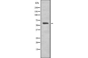 Western blot analysis of K2C1B expression in HEK293 cells ,The lane on the left is treated with the antigen-specific peptide. (Keratin 77 抗体  (Internal Region))