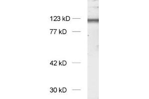 dilution: 1 : 1000, sample: synaptic membrane fraction of rat brain (LP1) (NMDA 1 Receptor 抗体  (AA 35-53))