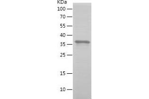 Western Blotting (WB) image for Golgi Membrane Protein 1 (GOLM1) (AA 101-401) protein (His tag) (ABIN7123180)