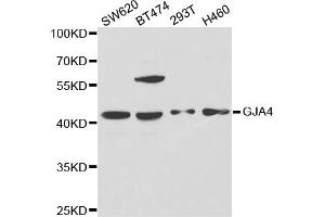 Western blot analysis of extracts of various cell lines, using GJA4 antibody (ABIN5971360) at 1/1000 dilution. (GJA4 抗体)