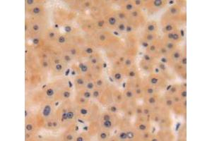 IHC-P analysis of liver tissue, with DAB staining. (C3 抗体  (AA 965-1303))