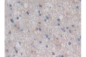 Immunohistochemistry (IHC) image for anti-Heat Shock 27kDa Protein Family, Member 7 (Cardiovascular) (HSPB7) (AA 1-170) antibody (ABIN7441055)