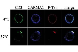 Immunocytochemistry analysis of CARMA1 using anti-CARMA1, pAb (AL220) . (CARD11 抗体  (N-Term))