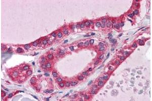 Human Thyroid: Formalin-Fixed, Paraffin-Embedded (FFPE) (WDR35 抗体  (N-Term))