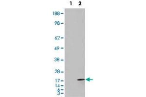 293 overexpressing FABP2 and probed with FABP2 polyclonal antibody  (mock transfection in first lane), tested by Origene. (FABP2 抗体  (C-Term))