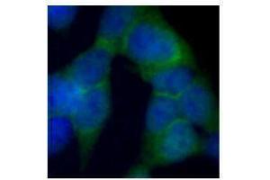 Immunofluorescence (IF) image for anti-DEAD (Asp-Glu-Ala-Asp) Box Polypeptide 1 (DDX1) antibody (ABIN2664923) (DDX1 抗体)