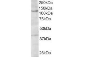 Image no. 1 for anti-Hermansky-Pudlak Syndrome 3 (HPS3) (C-Term) antibody (ABIN374450) (HPS3 抗体  (C-Term))