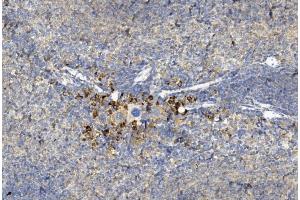 Immunohistochemistry (Paraffin-embedded Sections) (IHC (p)) image for anti-Gremlin 1 (GREM1) (AA 147-175), (C-Term) antibody (ABIN390078)