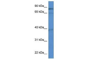 Western Blot showing ZCCHC7 antibody used at a concentration of 1-2 ug/ml to detect its target protein. (ZCCHC7 抗体  (C-Term))