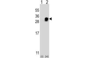 Western Blotting (WB) image for anti-Vesicle Transport through Interaction with t-SNAREs 1A (VTI1A) antibody (ABIN3003825) (VTI1A 抗体)