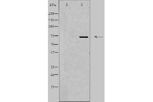 Western blot analysis of extracts from HepG2 cells, using DDX51 antibody. (DDX51 抗体  (C-Term))