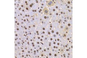 Immunohistochemistry of paraffin-embedded Mouse liver using HMGB1 antibody at dilution of 1:100 (x400 lens). (HMGB1 抗体  (AA 100-200))
