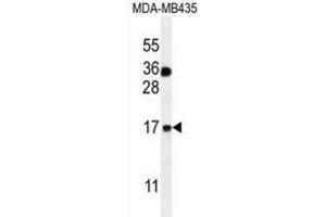 Western Blotting (WB) image for anti-S100 Calcium Binding Protein A1 (S100A1) antibody (ABIN2996370) (S100A1 抗体)