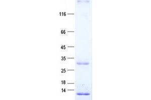 Western Blotting (WB) image for Opa Interacting Protein 5 (OIP5) protein (His tag) (ABIN2727890)