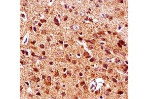 Gsk3b antibody immunohistochemistry analysis in formalin fixed and paraffin embedded mouse brain tissue. (GSK3 beta 抗体  (AA 30-59))