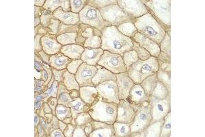 Immunohistochemistry (Paraffin-embedded Sections) (IHC (p)) image for anti-Major Histocompatibility Complex, Class I, A (HLA-A) (AA 35-285) antibody (ABIN3023100)