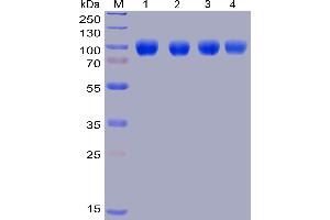 Lane 1: Human SIRPα, hFc-His tagged protein without freeze-thaw treatment, Lane 2: Human SIRPα, hFc-His tagged protein after one freeze-thaw cycle, Lane 3: Human SIRPα, hFc-His tagged protein after three freeze-thaw cycles, Lane 4: Human SIRPα, hFc-His tagged protein after five freeze-thaw cycles.