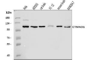 Western blot analysis of delta 1 Catenin/CAS/CTNND1 using anti-delta 1 Catenin/CAS/CTNND1 antibody (ABIN7602221).