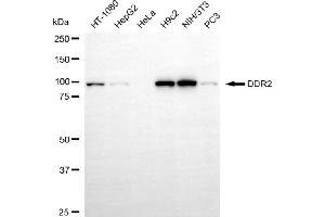 Western blotting analysis using DDR2 antibody (ABIN7798353).