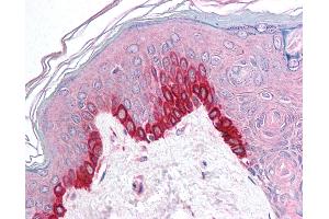 Anti-TRIM9 antibody IHC of human skin. (TRIM9 抗体  (C-Term))