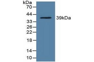 Figure. (Lactate Dehydrogenase C 抗体  (AA 1-332))