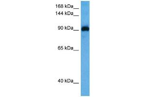 Host:  Rabbit  Target Name:  MYOCD  Sample Tissue:  Mouse Spleen  Antibody Dilution:  1ug/ml (Myocardin 抗体  (N-Term))