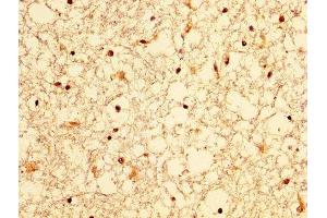 IHC image of ABIN7156316 diluted at 1:300 and staining in paraffin-embedded human brain tissue performed on a Leica BondTM system. (OCRL 抗体  (AA 121-271))