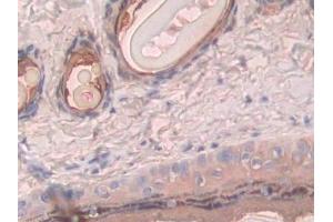 Immunohistochemistry (IHC) image for anti-phosphofructokinase, Platelet (PFKP) (AA 354-570) antibody (ABIN7443782)