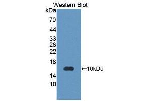 Western blot analysis of the recombinant protein. (PIM1 抗体  (AA 122-261))