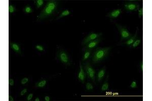 Immunofluorescence (IF) image for anti-Ribosomal Protein L9 (RPL9) (AA 93-191) antibody (ABIN562692)