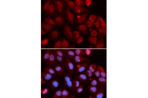 Immunofluorescence (IF) image for anti-Recombination Activating Gene 2 (RAG2) antibody (ABIN1876827) (RAG2 抗体)