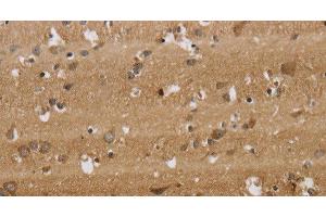 Immunohistochemistry of paraffin-embedded Human brain tissue using KCNMB2 Polyclonal Antibody at dilution 1:40 (KCNMB2 抗体)