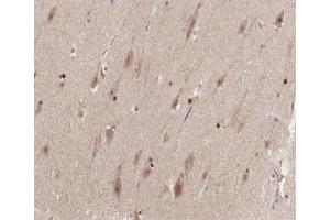 ABIN6267379 at 1/200 staining human brain tissue sections by IHC-P. (Cyclin B1 抗体  (pSer126))