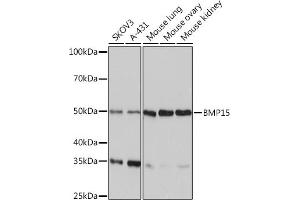 Western blot analysis of extracts of various cell lines, using BMP15 Rabbit mAb (ABIN7265896) at 1:1000 dilution. (BMP15 抗体)