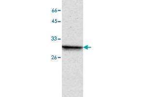 Western blot analysis of MCF-7 whole cell lystae with PPP4C monoclonal antibody, clone 2  at 1:1000 dilution. (PPP4C 抗体)