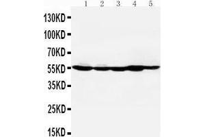 Anti-HDAC2 antibody, Western blotting Lane 1: MM453 Cell Lysate Lane 2: MCF-7 Cell Lysate Lane 3: HELA Cell Lysate Lane 4: SMMC Cell Lysate Lane 5: COLO320 Cell Lysate (HDAC2 抗体  (C-Term))