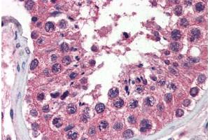 Human Testis (formalin-fixed, paraffin-embedded) stained with UNG antibody ABIN364332 at 10 ug/ml followed by biotinylated anti-mouse IgG secondary antibody ABIN481714, alkaline phosphatase-streptavidin and chromogen.