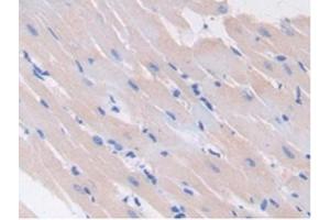 Immunohistochemistry (IHC) image for anti-Glutamate Decarboxylase 2 (Pancreatic Islets and Brain, 65kDa) (GAD2) (AA 188-374) antibody (ABIN7437707)