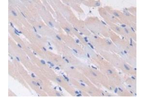 Detection of GAD2 in Rat Heart Tissue using Polyclonal Antibody to Glutamate Decarboxylase 2 (GAD2) (GAD65 抗体  (AA 188-374))