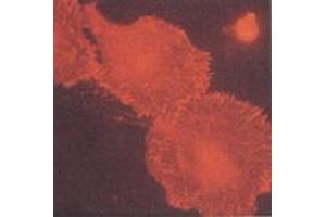 Human primary fibroblasts (MAb BB10, b3-Integrin) (Integrin beta 3 抗体)