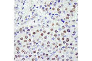 Immunohistochemistry (IHC) image for anti-Splicing Factor 3a, Subunit 1 (SF3A1) (AA 300-350) antibody (ABIN7449023)